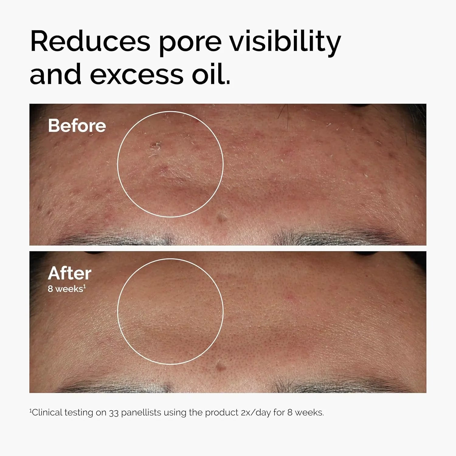 SkinEssentials Brightening Serum — Niacinamide & Alpha Arbutin