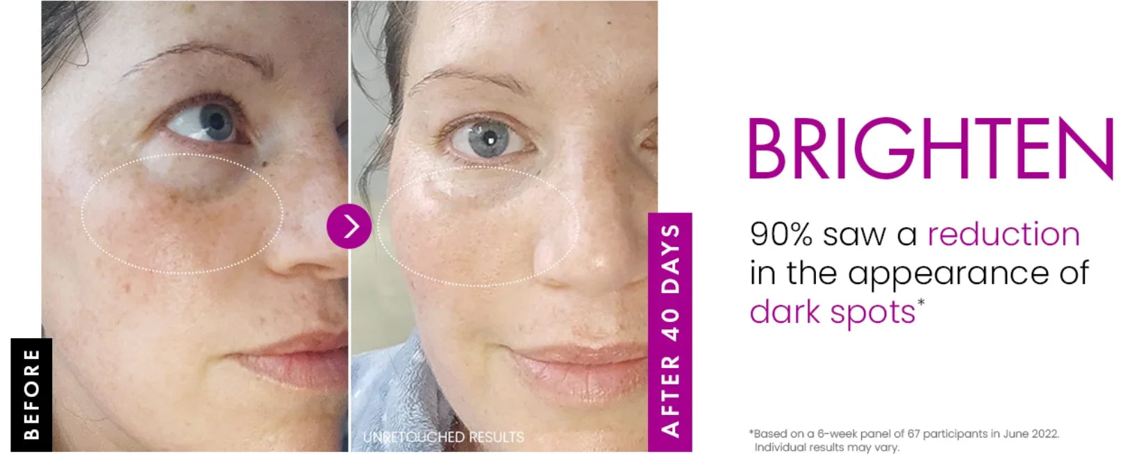 Collagen Peptide Face Cream – Day & Night Moisturizer for Plump, Younger Skin