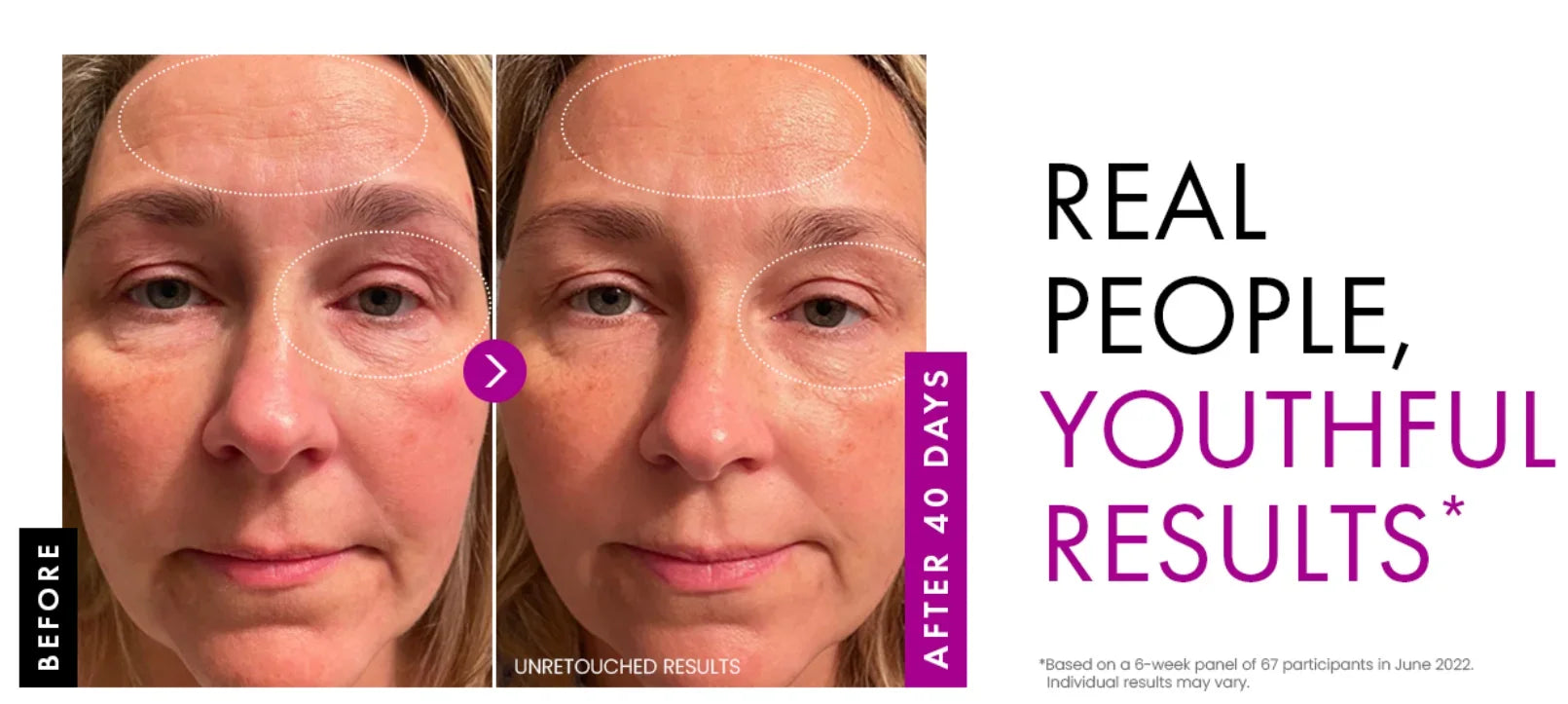 Collagen Peptide Face Cream – Day & Night Moisturizer for Plump, Younger Skin